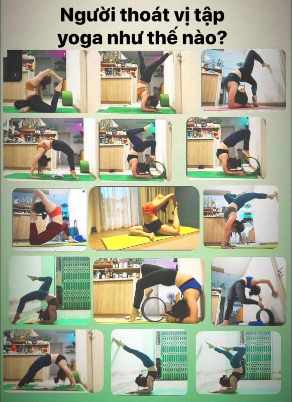 thoát vị đĩa đệm- cẩn thận lắm mà vẫn bị - học viên Thủy Garden sau khi tập trị liệu